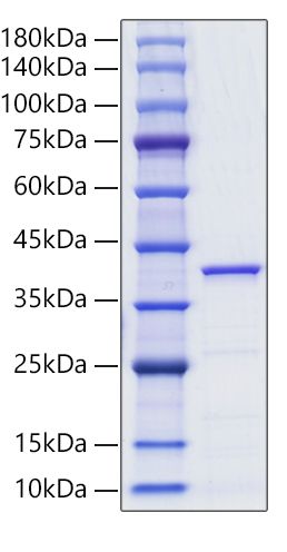 Recombinant Human Lactate Dehydrogenase A/LDHA Protein