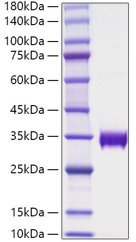 Recombinant Human AMBP Protein