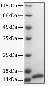 Recombinant Human Apolipoprotein B/APOB Protein