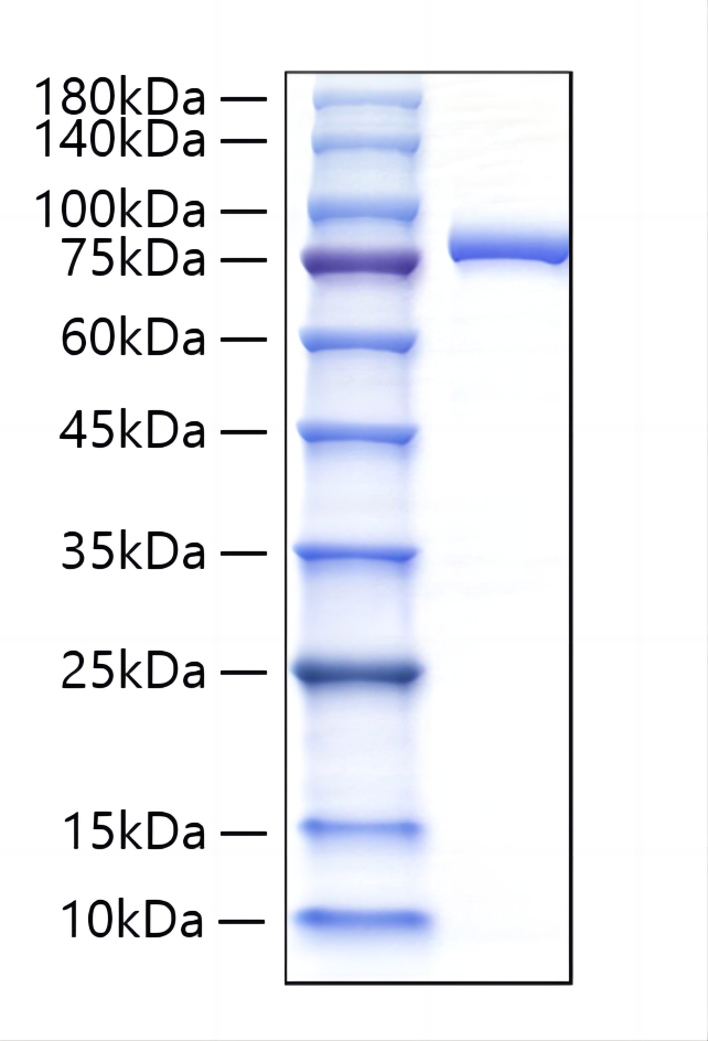 Recombinant Human Lactotransferrin/LTF Protein