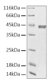 Recombinant Human Creatine Kinase MM/CKMM Protein