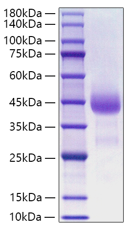 Recombinant Human Cathepsin B Protein