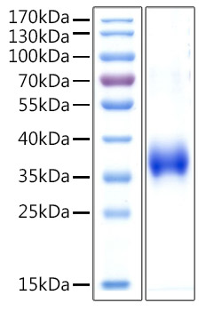 Recombinant Human Cathepsin L Protein