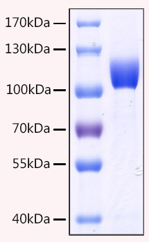 Recombinant Human MME/CD10 Protein