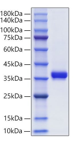 Recombinant Human Granzyme B/CTLA-1/GZMB Protein