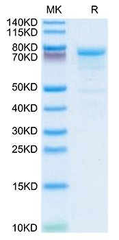 Recombinant Human Plasma Kallikrein/KLKB1 Protein