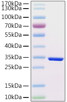 Recombinant Human Choriogonadotropin subunit beta 3/CGB3 Protein