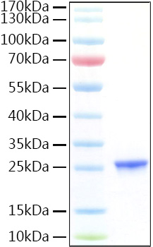 Recombinant Human CGB7 Protein