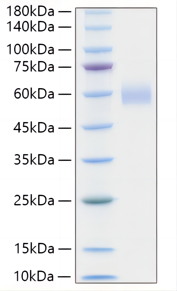 Recombinant Human Lp-PLA2/PLA2G7 Protein