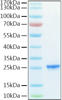 Recombinant Human PMKase/PMVK Protein