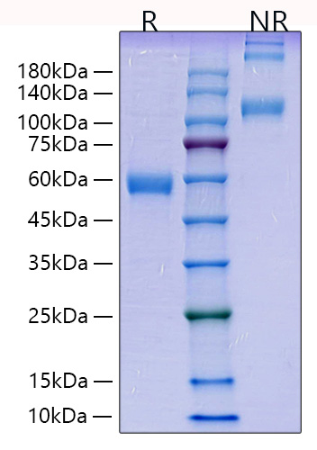 Recombinant Human Placenta growth factor/PlGF-131/PlGF-1 Protein