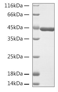 Recombinant Human Beta-actin/ACTB Protein