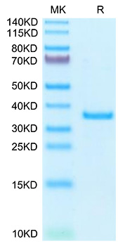 Recombinant Human SFRP2 Protein