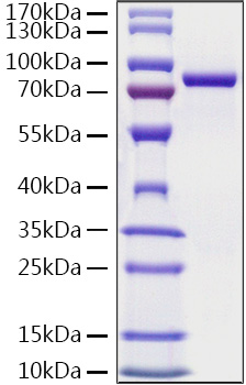 Recombinant Human Ezrin/EZR Protein