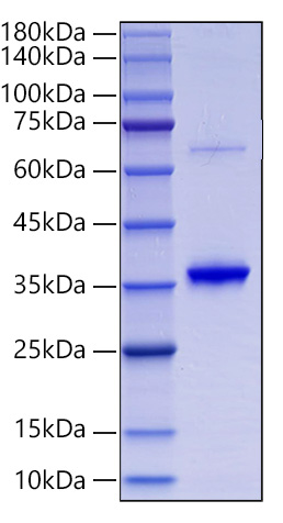 Recombinant Human Collagen II alpha 1/COL2A1 Protein