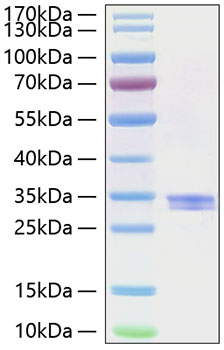 Recombinant Human IFI30 Protein