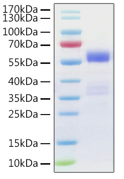 Recombinant Human NF-kB p65/RELA Protein