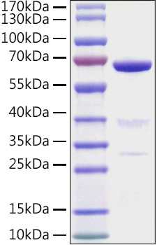 Recombinant Human MIS/AMH Protein