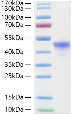 Recombinant Human RRM2 Protein