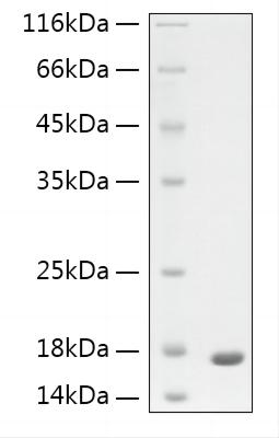 Recombinant Human GFAP protein