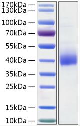 Recombinant Human Gamma-glutamyl hydrolase/GGH Protein