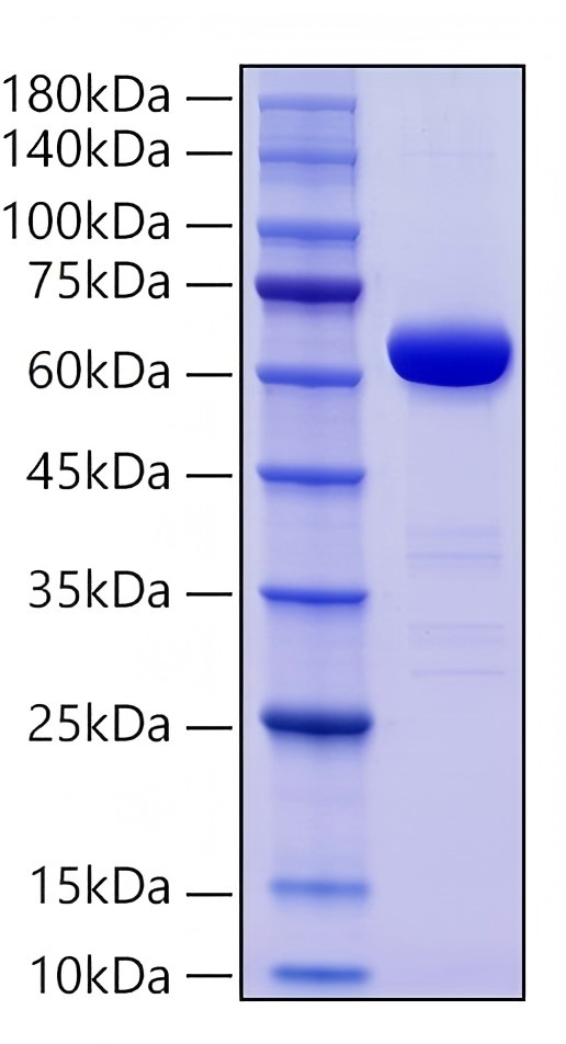 Recombinant Human Alkaline Phosphatase (Germ type) /ALPG Protein