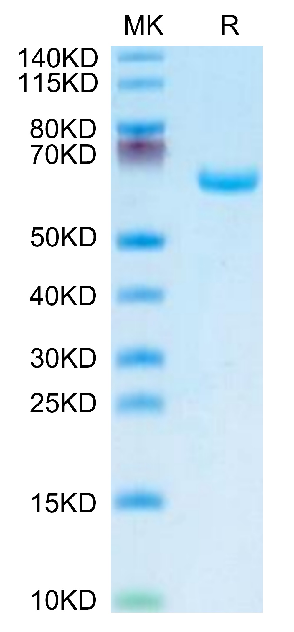 Recombinant Human Alkaline phosphatase (Placental type) /ALPP Protein