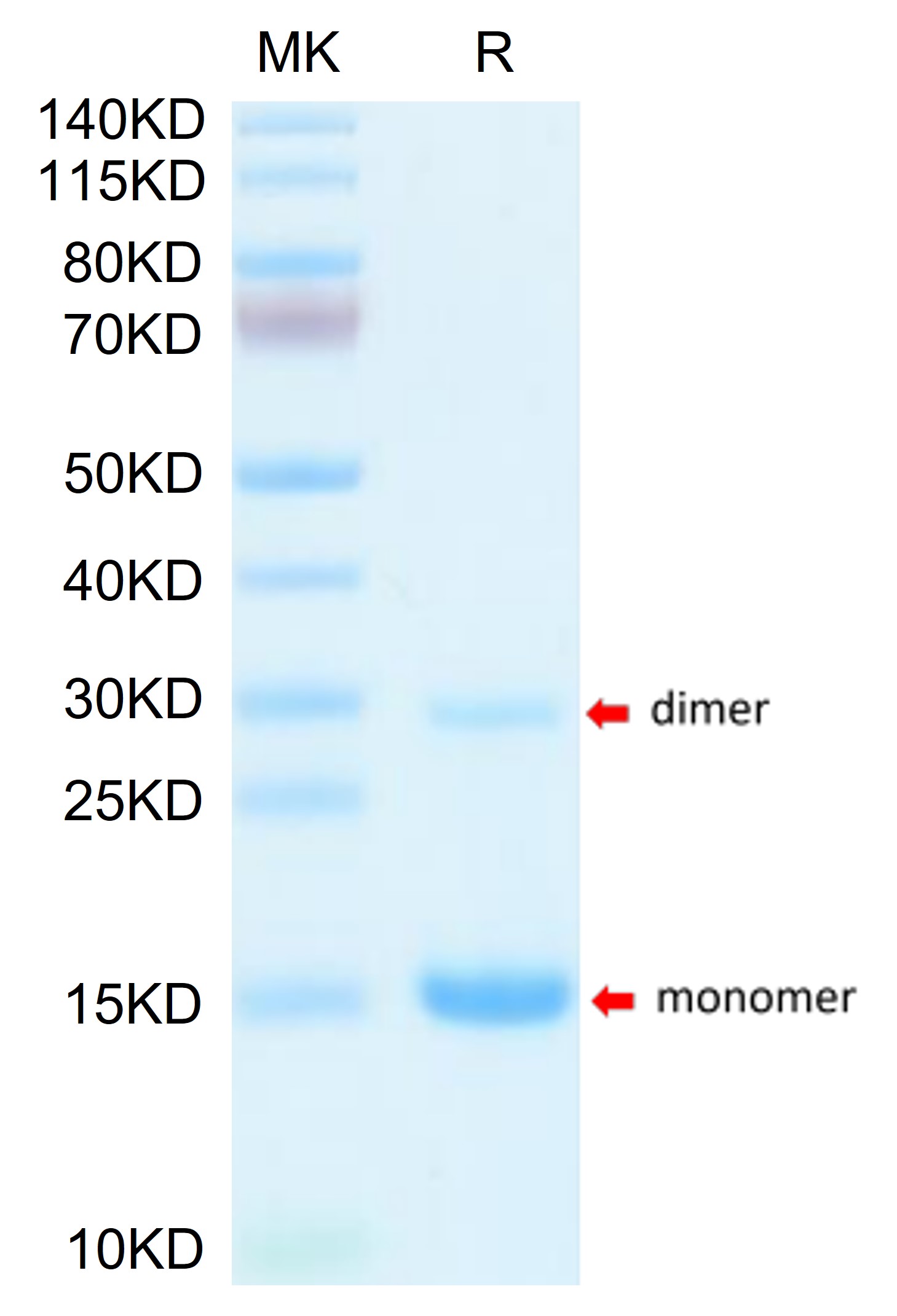 Recombinant Mouse S100-A9 Protein