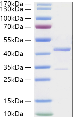 Recombinant Human PCBP1 Protein