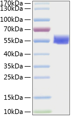 Recombinant Human Vimentin/VIM Protein