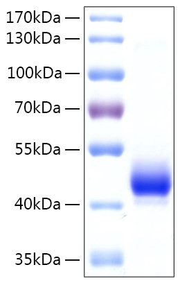 Recombinant Human EBP1 Protein