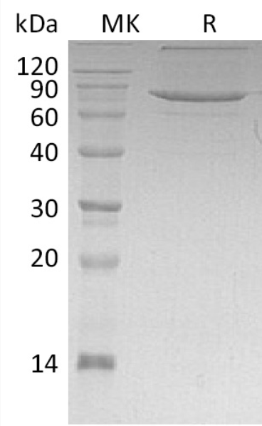 Recombinant Human XPNPEP1 Protein