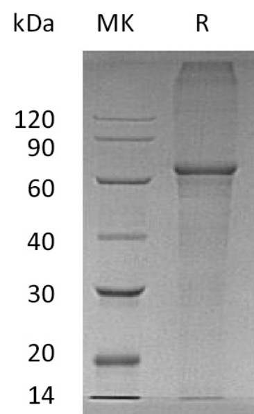 Recombinant Human XPNPEP3 Protein