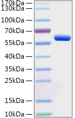 Recombinant Human Protein disulfide-isomerase/PDI Protein