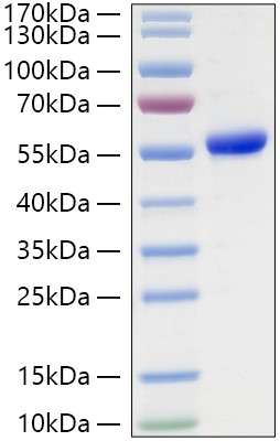 Recombinant Human Asparaginyl endopeptidase/Legumain/LGMN Protein