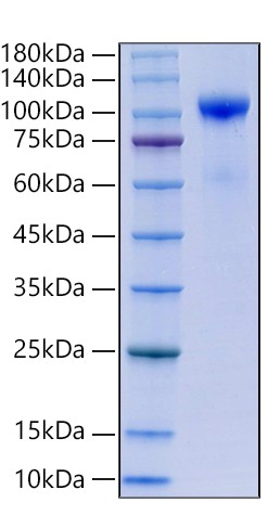 Recombinant Human HGF Activator/HGFA Protein