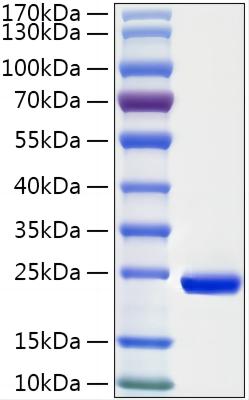 Recombinant Human Serglycin/SRGN Protein