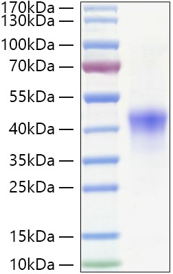 Recombinant Human NDRG1 Protein