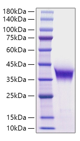 Recombinant Human ADPRH Protein