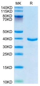 Recombinant Human Annexin A1/ANXA1 Protein