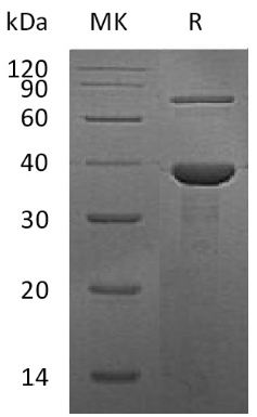 Recombinant Human Retinol-binding protein 3/RBP3 Protein