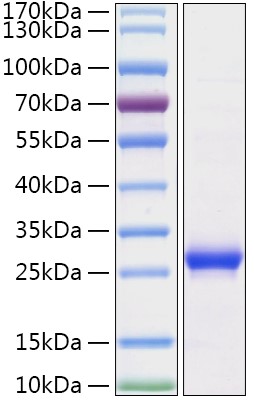 Recombinant Human Histone H1 Protein