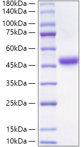 Recombinant Human Neutrophil cytosol factor 1/NCF1 Protein