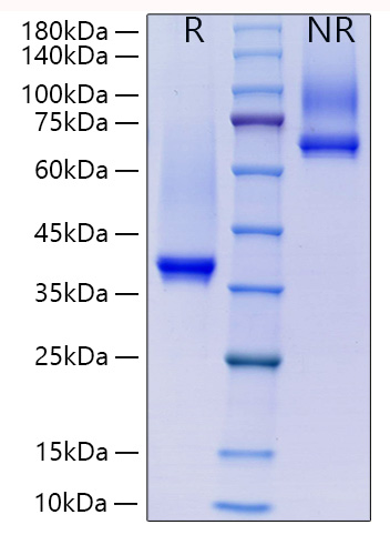 Recombinant Human IgG1 Protein